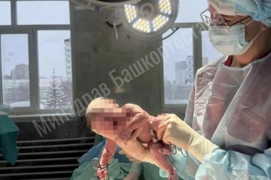 Врачи Уфы помогли родить женщине с редкой аномалией матки Врачи Уфы помогли родить женщине с редкой аномалией матки0